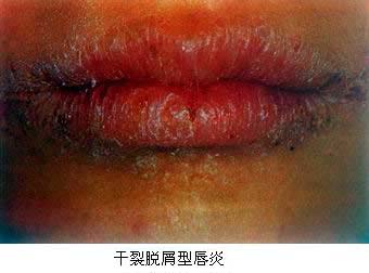 纯病