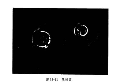 隐球菌病